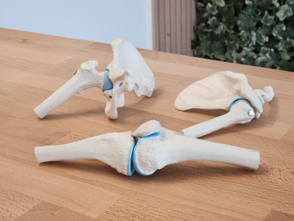 Modèle de hanche, d'épaule et de genou pour expliquer des pathologies